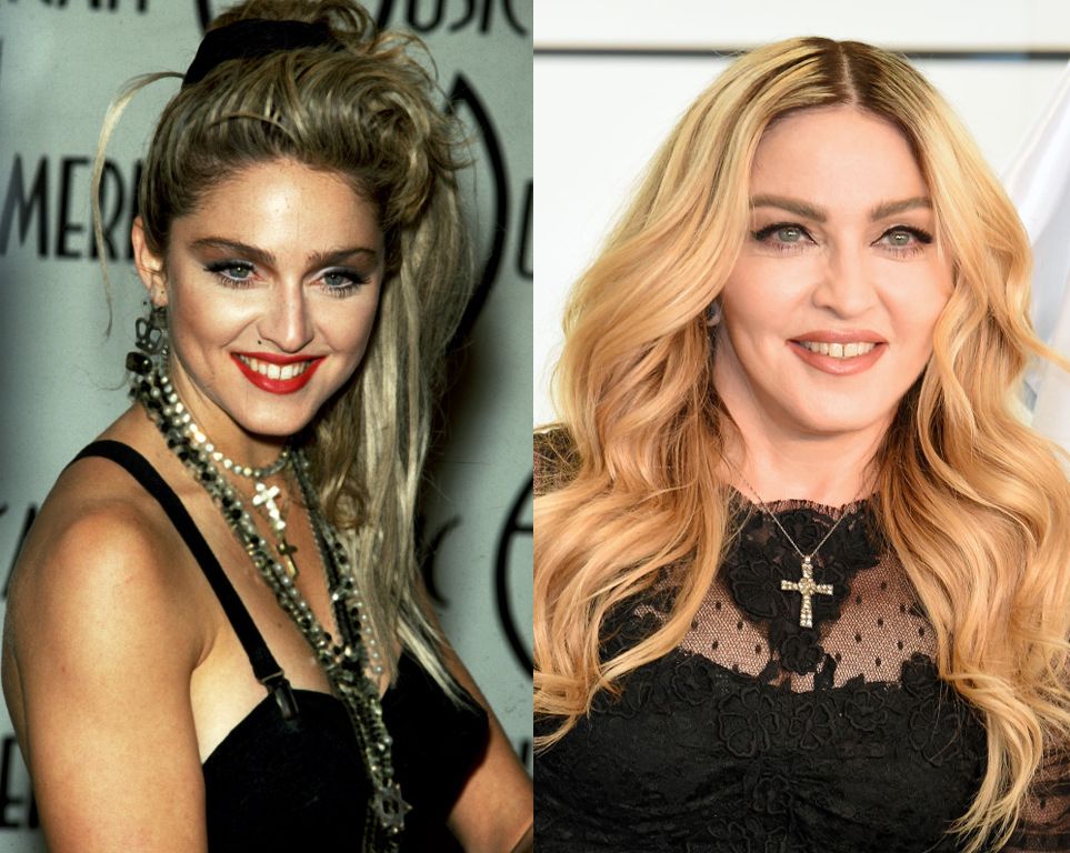 Madonna Plastic Surgery