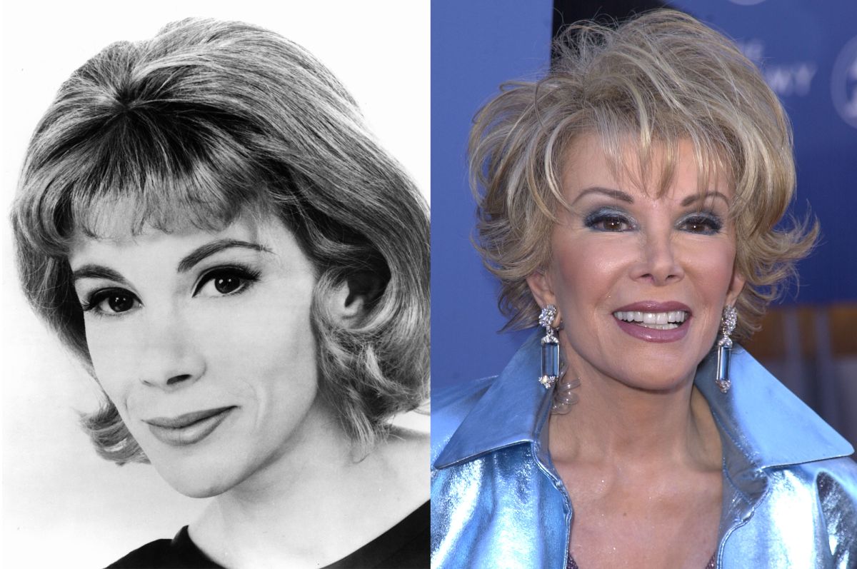 Joan Rivers Plastic Surgery
