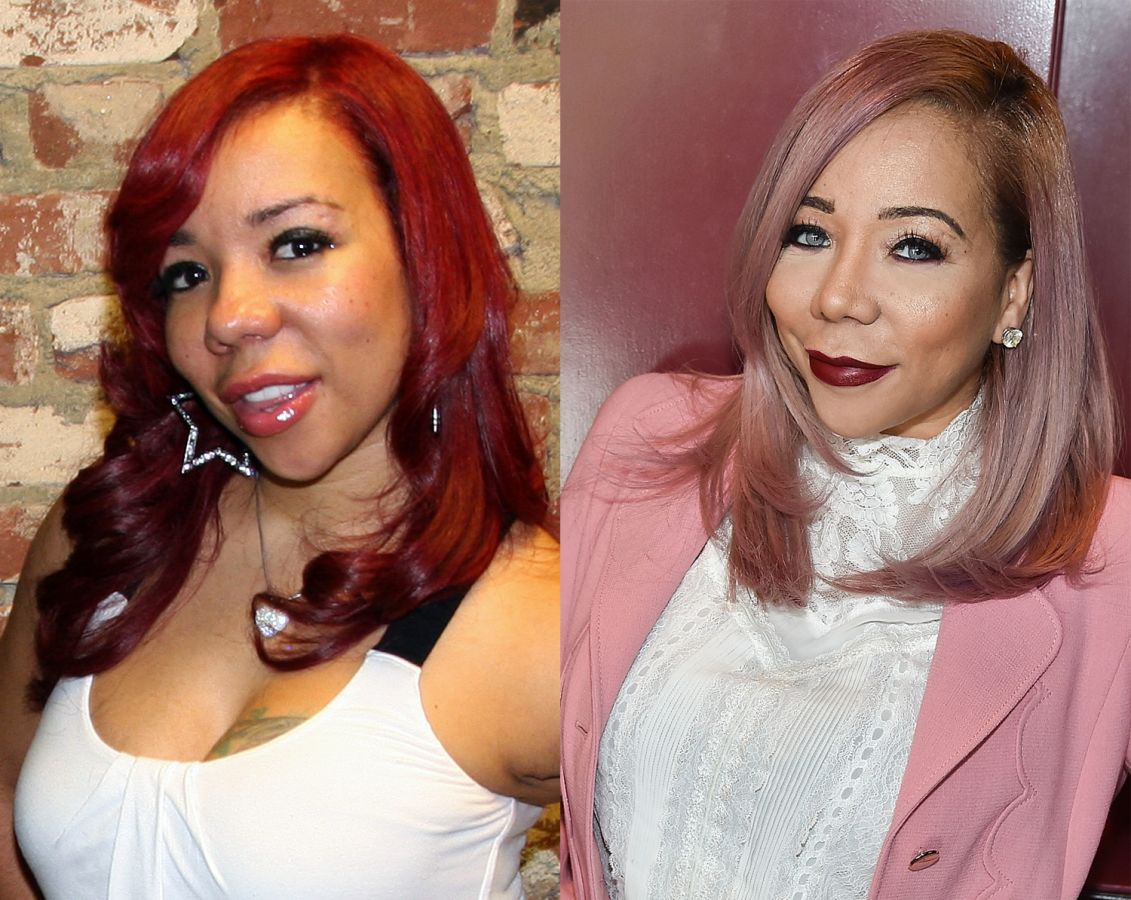 Tiny Plastic Surgery