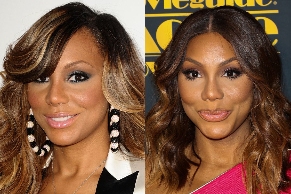 Wendy Williams Plastic Surgery