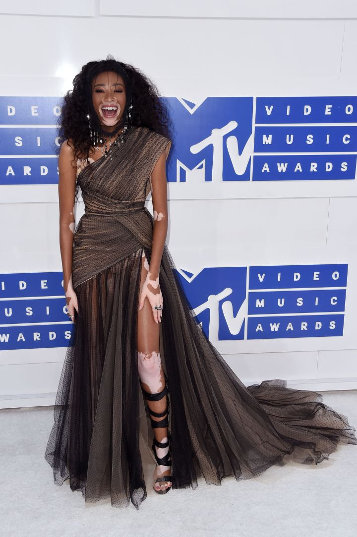Winnie Harlow