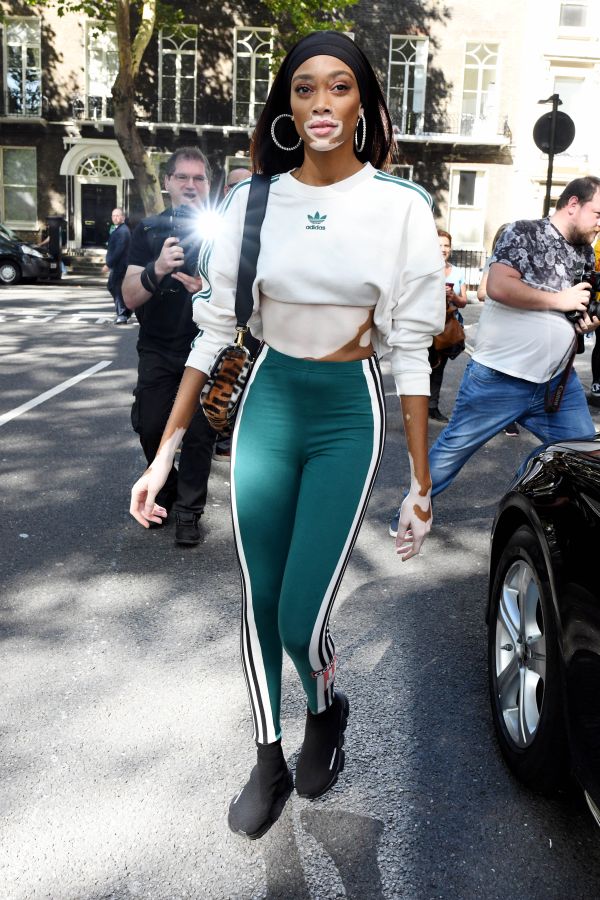 Winnie Harlow